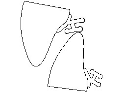 ]